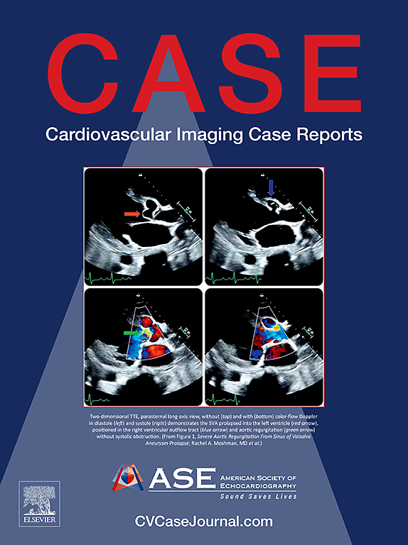 Go to journal home page - CASE